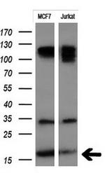 MSMB Antibody in Western Blot (WB)