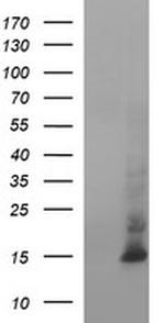 MSMB Antibody in Western Blot (WB)