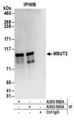 MSUT2 Antibody in Immunoprecipitation (IP)