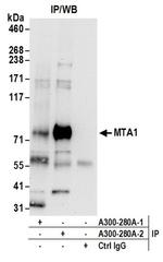 MTA1 Antibody in Western Blot (WB)