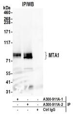 MTA1 Antibody in Western Blot (WB)