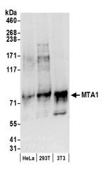 MTA1 Antibody in Western Blot (WB)