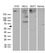 MTA3 Antibody in Western Blot (WB)