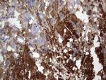 MTDH Antibody in Immunohistochemistry (Paraffin) (IHC (P))