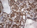 MTDH Antibody in Immunohistochemistry (Paraffin) (IHC (P))