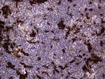 MTDH Antibody in Immunohistochemistry (Paraffin) (IHC (P))