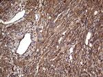 MTDH Antibody in Immunohistochemistry (Paraffin) (IHC (P))