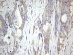 MTDH Antibody in Immunohistochemistry (Paraffin) (IHC (P))