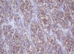 MTIF3 Antibody in Immunohistochemistry (Paraffin) (IHC (P))