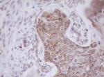 MTIF3 Antibody in Immunohistochemistry (Paraffin) (IHC (P))