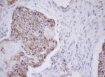 MTIF3 Antibody in Immunohistochemistry (Paraffin) (IHC (P))