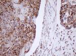 MTIF3 Antibody in Immunohistochemistry (Paraffin) (IHC (P))