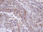 MTIF3 Antibody in Immunohistochemistry (Paraffin) (IHC (P))