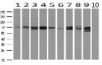 MTMR14 Antibody in Western Blot (WB)