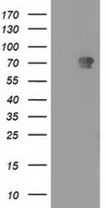 MTMR2 Antibody in Western Blot (WB)