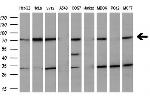 MTMR2 Antibody in Western Blot (WB)