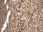 MTOR Antibody in Immunohistochemistry (Paraffin) (IHC (P))