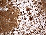 MTOR Antibody in Immunohistochemistry (Paraffin) (IHC (P))