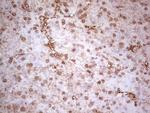 MTOR Antibody in Immunohistochemistry (Paraffin) (IHC (P))