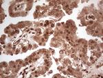 MTOR Antibody in Immunohistochemistry (Paraffin) (IHC (P))