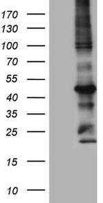 MTOR Antibody in Western Blot (WB)