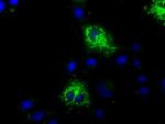 MTRF1L Antibody in Immunocytochemistry (ICC/IF)