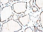 MTRF1L Antibody in Immunohistochemistry (Paraffin) (IHC (P))