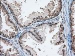 MTRF1L Antibody in Immunohistochemistry (Paraffin) (IHC (P))