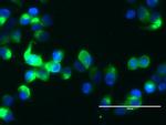 MUC1 Antibody in Immunocytochemistry (ICC/IF)