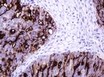 MUC1 Antibody in Immunohistochemistry (Paraffin) (IHC (P))