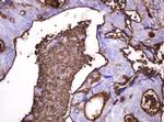 MUC1 Antibody in Immunohistochemistry (Paraffin) (IHC (P))