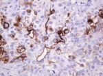 MUC1 Antibody in Immunohistochemistry (Paraffin) (IHC (P))