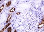 MUC1 Antibody in Immunohistochemistry (Paraffin) (IHC (P))