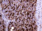 MUC1 Antibody in Immunohistochemistry (Paraffin) (IHC (P))