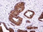 MUC1 Antibody in Immunohistochemistry (Paraffin) (IHC (P))