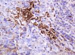 MUC1 Antibody in Immunohistochemistry (Paraffin) (IHC (P))