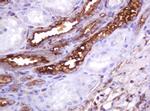 MUC1 Antibody in Immunohistochemistry (Paraffin) (IHC (P))