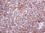 MUC1 Antibody in Immunohistochemistry (Paraffin) (IHC (P))