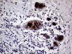 MUC1 Antibody in Immunohistochemistry (Paraffin) (IHC (P))