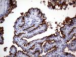 MUC1 Antibody in Immunohistochemistry (Paraffin) (IHC (P))