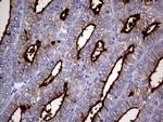 MUC1 Antibody in Immunohistochemistry (Paraffin) (IHC (P))