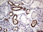 MUC1 Antibody in Immunohistochemistry (Paraffin) (IHC (P))