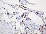 MUC1 Antibody in Immunohistochemistry (Paraffin) (IHC (P))