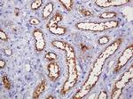 MUC1 Antibody in Immunohistochemistry (Paraffin) (IHC (P))