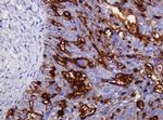 MUC1 Antibody in Immunohistochemistry (Paraffin) (IHC (P))