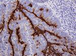 MUC1 Antibody in Immunohistochemistry (Paraffin) (IHC (P))