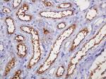 MUC1 Antibody in Immunohistochemistry (Paraffin) (IHC (P))