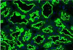 MUC1 Antibody in Immunocytochemistry (ICC/IF)