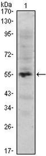 MUM1 Antibody in Western Blot (WB)