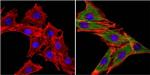 MUSK Antibody in Immunocytochemistry (ICC/IF)